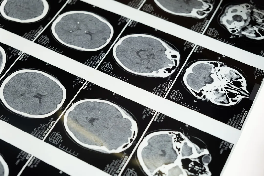 Lumafield publishes ct scans of byd car parts